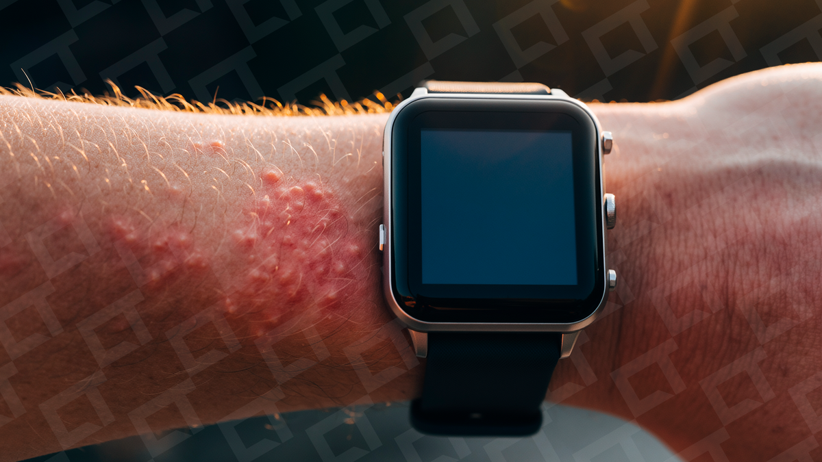 5 formas de limpar smartwatch corretamente e evitar alergias