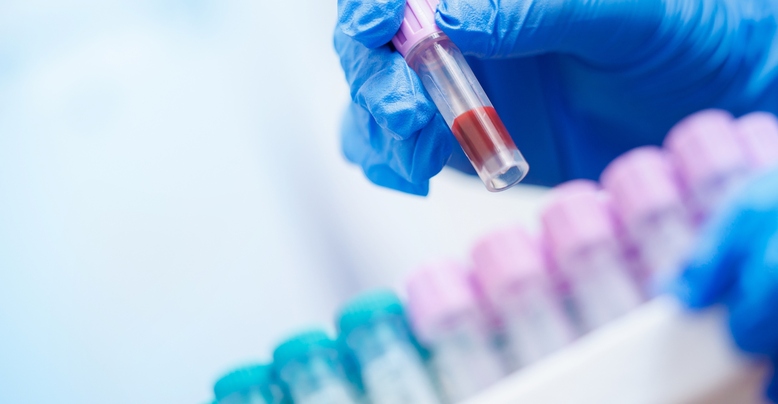 Fleury amplia tecnologia LDTD para análises mais rápidas