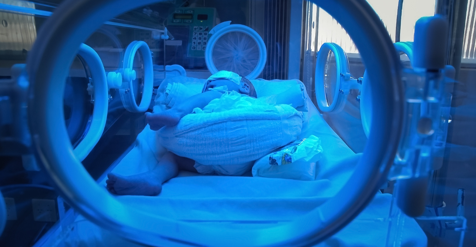 Santa Casa BH usa neuromonitoramento em UTI neonatal