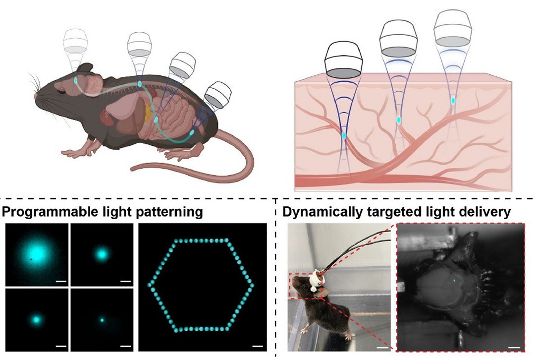 Ultrassom gera luz no corpo para uso médico