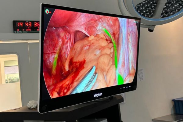 Tacchini investe em tecnologia cirúrgica 4K com fluorescência