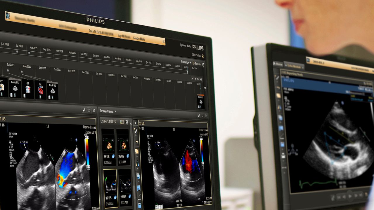 Conexão de dados transforma jornada diagnóstica em cardiologia