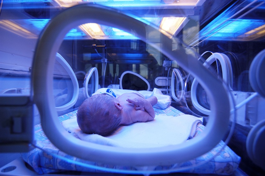 Triagem neonatal da AME permite diagnóstico antes dos 30 dias